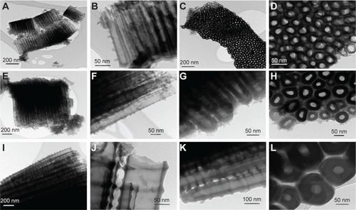 Figure 4 Transmission electron microscopy images of the TiO2 NTs.Notes: (A–D) Represents the NTs with 15 nm diameters; (E–H) represents the NTs with 50 nm diameters; and (I–L) represents the NTs with 100 nm diameters.Abbreviation: NTs, nanotubes.