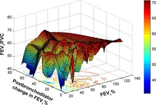 Figure 3 The MATLAB 3D figure showing the relationship between FEV1, postbronchodilator change in FEV1%, and basal FEV1% of patients.Abbreviations: FEV1, forced expiratory volume in 1 second; FVC, forced vital capacity.
