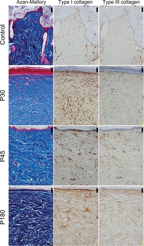 Figure 1 The histology of control and near-infrared (NIR) irradiated skin (×200 magnification). The left column shows Azan-Mallory staining, the middle column shows type I collagen staining, and the right column shows type III collagen staining. Images from top to bottom show control, postirradiation day 30 (P30), postirradiation day 45 (P45), postirradiation day 180 (P180). Scale bar = 50.0 μm.