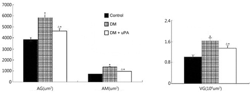 Figure 2. Effect of uPA on AG, AM, and VG in rat renal tissues of control, diabetic rats (DM), and diabetic rats treated with uPA (DM + uPA) group. AG, glomerular mean area. AM, mesangial area. VG, glomerular mean volume. All the data are expressed as mean ± standard deviation. *p < 0.01, compared with control group. Δp < 0.01, compared with diabetic rat groups.