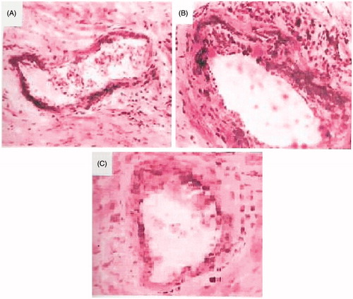 Figure 1. Microscopic graphs showing the atherosclerosis of coronary artery. Sections stained with Oil-Red-O and hematoxylin, 40×. (A) Rats fed with normal rat chow; (B) rats given atherogenic diet; and (C) atherogenic rats treated with TRF for six weeks.