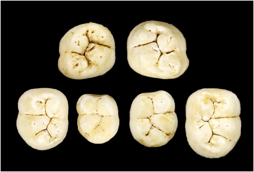 Figure 2. E-JUV individual #1. Top row (left to right): Left maxillary M2; right M2. Bottom row: mandibular left M2, M1; right M1, M2.