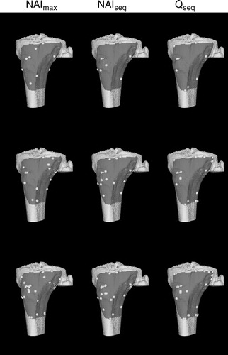 Figure 6. Proximal tibia surface model and registration points generated using the point-selection algorithms. From top to bottom are point sets of size 9, 18, and 30.