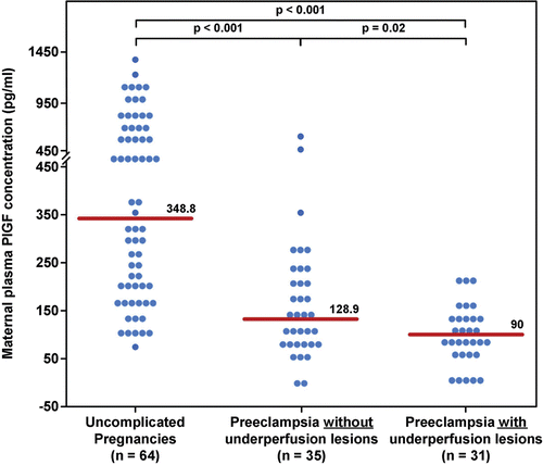 Figure 1.  Maternal plasma concentration of PlGF between women with an uncomplicated pregnancy and women with late-onset PE with and without underperfused placental lesions. Women with late-onset PE without underperfused placental lesions had a lower median plasma PlGF concentration than women with uncomplicated pregnancies. Similarly, women with late-onset PE with underperfused placental lesions had a lower median plasma PlGF concentration than women with uncomplicated pregnancies. Among women with late-onset PE, those who had underperfused placental lesions had a lower median plasma PlGF concentration than those without these lesions.