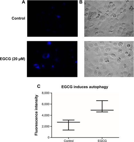 Figure 3 EGCG-induced autophagy in SSC-4 cells, using fluorescence microscopy evaluation after MDC staining.