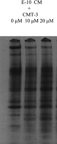 Figure 6 Effect of CMT‐3 on total secreted protein levels in E‐10 CM. E‐10 Cells were cultured in 35S TransLabel‐containing SFM overnight. CM was collected and electrophoresed on SDS‐PAGE. The gel was dried and exposed to X‐ray film.