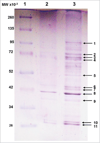 Figure 1. SDS-PAGE analysis of proteins from purified bacteriophage φEf11(Δ61-65, FL1C39-44). Lane 1, molecular weight markers (Fermentas Broad Range Protein Ladder; Lanes 2 and 3, dissociated, purified bacteriophage φEf11(Δ61-65, FL1C39-44).