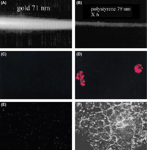 Figure 2. (A and B) Comparison of scattering properties of AuNPs (A) and polystyrene NPs (B) of the same size (B). (C and D) Comparison of reflectance images of SiHa cells labeled with BSA/Au conjugates (C) and anti-EGFR gold conjugates (D). (E and F) Comparison of reflectance images of cervical biopsies labeled with anti-EGFR antibodies/AuNP conjugates for normal tissue (E) and abnormal tissue (F). Due to strong scattering from targeted AuNPs, cancer cells and tissues can be differentiated from normal ones. All images were taken by a laser scanning confocal microscope in reflectance mode. Adapted from (CitationHuang and El-Sayed 2010) (68).