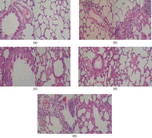 Figure 6.  The cut sheets of the lung. Sections were stained by hematoxylin and eosin (200×): (a) normal control rat; (b) asthmatic control group; (c) treated with DXM; (d) treated with high dose of α-asarone (4 cm2); (e) treated with low dose of α-asarone (1.5 cm2).