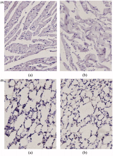 Figure 6. Histopathologic studies of colon (A) and rectum (B). (a) Saline and (b) LFX microspheres.