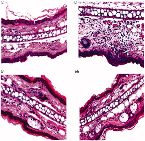 Figure 6. Effect of MF on croton oil-induced inflammatory cell infiltration of mouse ear. H&E-stained histological sections were prepared from ears resected 16 h after challenge: (a) unchallenged ear, (b) ear from mouse challenged with croton-oil in the absence of any treatment, (c) ear from mouse challenged with croton-oil post-treated with PT emulsion, and (d) ear from mouse challenged with croton-oil post-treated with commercial cream. Magnification: 40×.