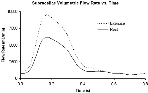 Figure 10. Rest and exercise supra-celiac flow waveforms for the 67-year-old female. The rest flow waveform was experimentally acquired using PCMRI. The exercise flow waveform was generated by shortening the diastolic portion of the rest curve by one-third and scaling the mean volumetric flow rate by a factor of two.