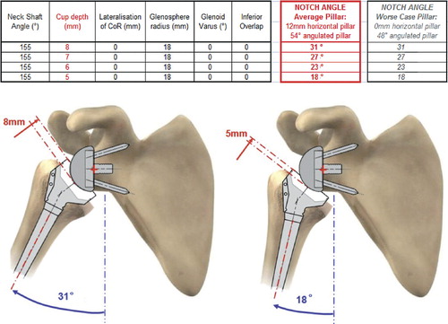 Figure 4. Influence of reduction of cup depth on the notch angle. (Simulation of maximal adduction in average scapular morphology and in worse-case scapular anatomy: no horizontal pillar. Images of average scapular morphology).