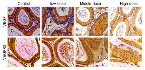 Figure 2. VEGF and VEGFR2 were downregulated in epididymal tissues of arsenic-exposed rats. Representative images of immunohistochemical staining using antibodies against VEGF (a) and VEGFR2 (b). VEGF, Vascular endothelial growth factor; VEGFR2, VEGF receptor 2