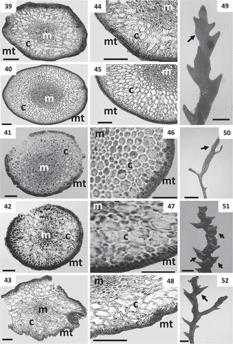 Figs 39–52. Cross sections of thalli and details of receptacles of Cystoseira 2 (here proposed as Treptacantha). Figs 39–48. Primary branches. Fig. 39. Cystoseira abies-marina (TFC Phyc 15259). Upper sublittoral morphotype. Fig. 40. Cystoseira abies-marina (TFC Phyc 15256). Sublittoral morphotype. Fig. 41. Cystoseira usneoides (TFC Phyc 1402). Fig. 42. Cystoseira algeriensis (HGI – A 1289). Fig. 43. Cystoseira mauritanica (TFC Phyc 15271). Figs 44–48. Details of the three vegetative tissues. Fig. 44. Cystoseira abies-marina (TFC Phyc 15259). Upper sublittoral morphotype. Fig. 45. Cystoseira abies-marina (TFC Phyc 15256). Sublittoral morphotype. Fig. 46. Cystoseira usneoides (TFC Phyc 1402). Fig. 47. Cystoseira algeriensis (HGI – A 1289). Fig. 48. Cystoseira mauritanica (TFC Phyc 15271). Figs 49–52. Receptacles (arrows). Fig. 49. Cystoseira abies-marina (TFC Phyc 15256). Fig. 50. Cystoseira usneoides (TFC Phyc 1402). Fig. 51. Cystoseira algeriensis (HGI – A 1289). Fig. 52. Cystoseira mauritanica (TFC Phyc 15271). Meristoderm (mt), cortex (c) and medulla (m). Scale bars: Figs 39–48 = 100 μm; Figs 49–52 = 1 mm.