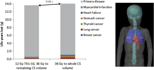 Figure 3. Number of life years lost (LYL) attributable to various late complications and failure to control the primary disease for two different prescription strategies. Even though the primary disease dominates the LYL there is an estimated gain if lowering the dose to the Th1–Th10 part of the craniospinal target. In the right hand panel, the anatomical position of the heart, lungs, thyroid, mammary glands and stomach are shown in relation to the craniospinal target (in cyan).