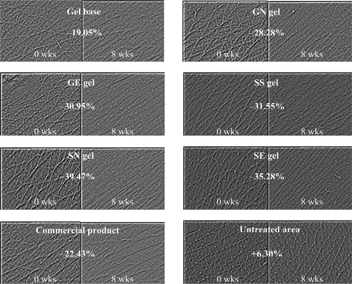 Figure 5.  Comparison of the skin roughness before (left) and after application for 8 weeks (right) and % changes of the arithmetic average roughness (Ra) values of various topical formulations. (GN gel, gel containing non-elastic niosomes loaded with gallic acid; GE gel, gel containing elastic niosomes loaded with gallic acid; SS gel, gel containing the unloaded semi-purified fraction; SN gel, gel containing non-elastic niosomes loaded with the semi-purified fraction; SE gel, gel containing elastic niosomes loaded with the semi-purified fraction.)