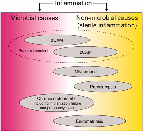 Figure 1. Schematic drawing of the pathogenesis of complications during pregnancy involving inflammation. Inflammation induced by microbial or non-microbial causes facilitate pregnancy complications such as preterm labor/birth, miscarriage, implantation failure, preeclampsia, chronic endometritis, and endometriosis. The causes of each disease tend to be of either microbial or non-microbial etiology; however, they often overlap. aCAM: acute chorioamnionitis; cCAM: chronic chorioamnionitis.