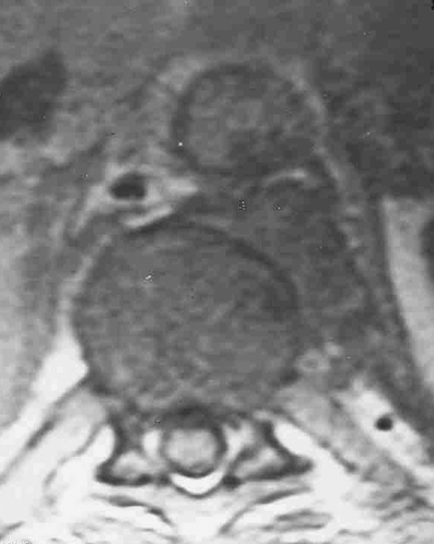 Figure 2.  Axial view.