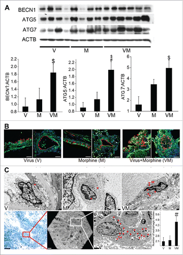 Figure 8. Enhanced autophagy in SIV-infected macaques exposed to morphine. (A) Total cellular extract from frozen macaque lung tissues from SIV (V group, n = 4), morphine (M group, n = 4) or SIV+morphine-injected macaques (VM group, n = 6) were probed or reprobed for the expression of autophagic markers BECN1, ATG5 and ATG7 by western blot. Graphs represent the average densitometry of the protein expression from each group. (B) The paraffin-embedded macaque lung sections immunostained for LC3B and endothelial marker (VWF). Magnification: 60X. Scale Bar 50 μm. (C) Representative TEM images of macaque lung sections. The upper panel represents 4000X magnification of endothelial cells lining the blood vessels from the macaques in the respective groups with red triangles pointing at the autophagic bodies (autophagosomes or autolysosomes). Lower panel images are of C088 macaque from the VM group. The first image (20X) is a crystal violet stained section from the cut block used for processing the tissue for TEM imaging, representing one of the areas with proliferating endothelial cells. The red box represents the approximate area of the TEM image shown in the middle, lower panel (250X). Further higher magnification image (2000X) of the inset shows a remarkably higher number of autophagic bodies in one of the cells. The graph is the average number of autophagic bodies in at least 30 endothelial cells per group (n = 3 for V or M group and n = 4 for VM group). #P < 0.05, ###P < 0.001 vs. M, $P < 0.05, $$$P < 0.001 vs V. Scale bars: 500 nm.