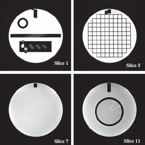 Figure 1. Examples of ACR phantom images. In slice 1 the hole-array pairs are used for high-contrast spatial resolution and the ramps in the middle for slice thickness accuracy. Slice 5 together with measurements from slice 1 and the sagittal image are used for the geometric accuracy determination. Image intensity uniformity is determined from slice 7 and slices 8 to 11 are used for low-contrast object detectability measurement.