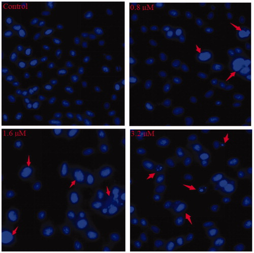 Figure 5. Hoechst staining of 15a-treated K562 cells. The red arrows point to the cells with obvious morphological changes of apoptosis.