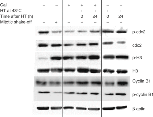 Figure 3. Representative example of two separate experiments of western blot analysis of the effect of treatment with Cal and/or HT at 43°C on Cdc2-PTyr15, total Cdc2, H3-PSer10, total H3, p-cyclin B1, total cyclin B1 and β-Actin in SW-1573 cells.