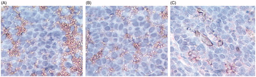 Figure 7. Analysis of CD31 expression by immunohistochemistry. Immunohistochemical peroxidase staining of CD31 in xenograft breast tumors of (A) Control, (B) GA and (C) GAL treatment groups. Presence of dark stain indicated positive staining for the primary antibody.