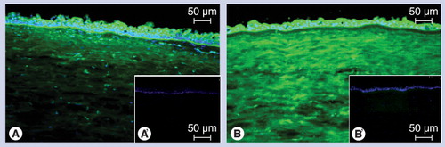 Figure 4. Visualization of transglutaminase activity in human cornea.(A) Endogenous transglutaminase (TGase) incorporates biotinylated cadaverine in the presence of calcium at pH 7.4 into the tissue. Made visible using streptavidin-dichlorotriazinylaminofluorescein (green fluorescence), the epithelial activity can be attributed to TGase-1 and -3, while the stromal activity can be assigned to TGase-2. (B) Exogenously added TGase-2 crosslinks the tagged peptide into all the layers of the cornea with preference for the stroma, indicating the presence of abundant enzyme substrate sites for this enzyme here. (A´) and (B´): Calcium chelation with ethylene glycol tetra-acetic acid abolishes enzymatic activity.