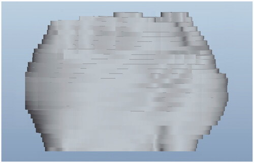 Figure 4. Prototype of the same tumour constructed in ProE® from 30 microCT slices.