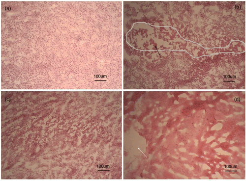 Figure 6. Hematoxylin/eosin staining of EMT6 tumor immediately after treatment for control group and three treatment groups, respectively. (a) The control group showed an infiltrating growth trend. (b) The injecting NaOH solution group with the black arrow indicating necrotic tumor cells. (c) The hyperthermia group showing no significant damage. (d) The sodium group with the white arrow demonstrating the injection zone of sodium and cells showing necrosis around the injection zone.
