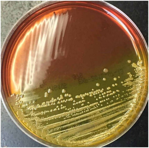 Figure 1. Bcc growth and colonial isolation on BCSA medium. BCSA agar plate seeded by cross streaking with a Bcc strain showing yellow colour in the section with bacterial growth (Taken from Landes N. et al. 2016 under the terms and conditions of licence number 5687200897100 (ELSEVIER)).