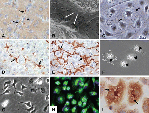 Figure 5.  Major nonparenchymal cell types of the liver. Top row: CD-31 staining of liver sinusoidal endothelial cells (LSEC) lining vascular walls of whole liver (A), scanning electron micrograph of the endothelial lining of the liver sinusoids showing extensive patches of fenestrae (arrows) (B), and primary LSEC showing typical morphology in vitro (C). Middle row: HSC (GFAP) in normal liver (D), myofibroblastic HSC (µSMA) in fibrotic liver (E), and isolated qHSC showing storage of vitamin A as bright “floating” vesicles within the cell body. Upon activation or injury the HSC undergo extensive morphological and biochemical changes, which include the synthesis, secretion and restructuring of ECM molecules. Bottom row: Kupffer cells (KC) showing their dynamic morphology (G), their identification with CD68 showing extended projections on the cell bodies used for contact with other cells (H), and a magnified view showing KC loaded with vesicles containing cytokines and other secretory factors (I).