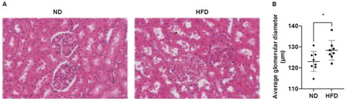 Figure 2. Pathological alterations in the kidneys of rats induced by a high-fat diet. (A) Representative images of HE staining of renal tissues (magnification = 30×, scale bar = 100 μm). (B) The sizes of the glomeruli in the two groups of rats. ND, normal diet; HFD, high-fat diet. Data are displayed as the mean ± SD. * p < 0.05 vs. the ND group; n = 8 per group.
