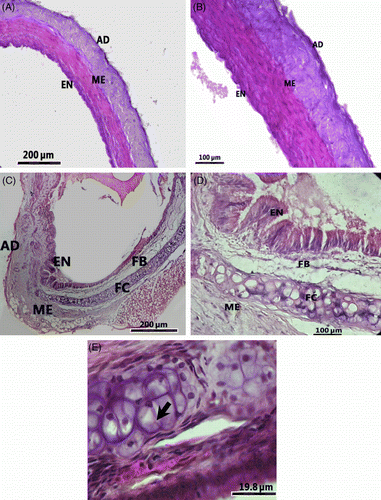 Figure 3.  Transverse sections of similar areas of thoracic aorta of a control rat (24 weeks no stress; A and B), and a rat stressed for 24 weeks (C and D) and a part of the aorta of a stressed rat under high magnification to show a portion of an atherosclerotic plaque (E) and foam cells (arrow). Note the thickening of wall of the aorta and a fibrous layer in the vessel of the stressed rat. B and D are higher magnification images of A and C, respectively. Hematoxylin–eosin stain; AD, adventitia; EN, endothelium; FB, fibrous layer; FC, foam cells; ME, media.