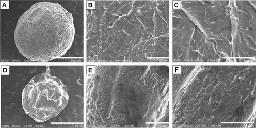 Figure S2 The transmission electron microscopy (SEM) photographs of the synthesized chitosan spheres.Notes: Panel (A) is an SEM photograph of a whole chitosan sphere. Panels (B) and (C) are the “zoom-in” counterparts of (A). Panel (D) is an SEM photograph of a sectioned chitosan sphere. Panels (E) and (F) are the “zoom-in” counterparts of (D). The scale bars are 1 mm for (A) and (D), 100 μm for (B) and (E), and 50 μm for (C) and (F), respectively.