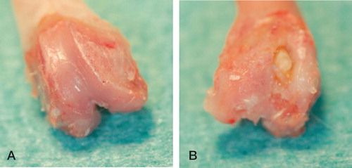Figure 1. Clinical appearance of osteomyelitis. Condyles of a control femur (A) and an infected femur (B).