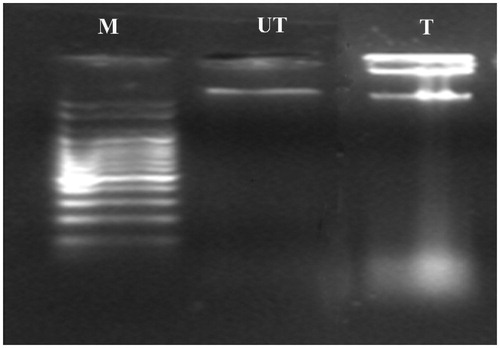 Figure 9. DNA fragmentation assay.Where, M, Marker; UT, untreated cells at 48 h; T- MDA-MB-231 cells exposed with GNPs.