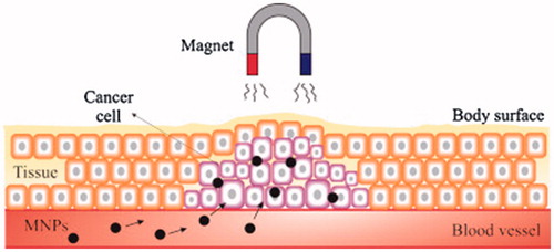 Figure 4. Scheme image of a magnetic drug delivery system