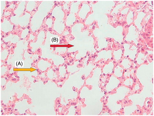 Figure 2. Normal group: a section of the mouse lung tissue showing alveolar septa lined with normal pneumocytes (A, yellow arrow) and normal alveolar spaces (B, red arrow). (Hematoxylin and eosin-stained paraffin sections; H&E × 400.)