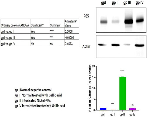 Figure 2. Western blot assay of p65 protein levels in mice different groups.