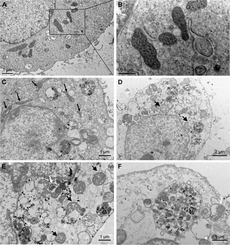 Figure S2 TEM images of HUVECs exposed to the SiNPs (50 μg/mL) for 24 hours.Notes: (A) Control group. (B) The magnification of selected area of control showed evidently intact mitochondria. (C) The induction of mitochondrial swelling and cristae rupturing and disappearance after SiNPs exposure (black arrows), and also SiNPs deposition in mitochondria. (D and E) Severe mitochondrial swelling in SiNPs-treated endothelial cells (black arrows), and (E and F) autophagosome including cytoplasmic material, especially impaired mitochondria (white arrow).Abbreviations: TEM, transmission electron microscopy; HUVECs, human umbilical vein endothelial cells; SiNPs, silica nanoparticles.