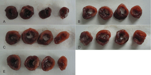 Figure 2.  Effects of ginsenoside Rb3 on myocardial infarct size in myocardial ischemia-reperfusion injury in rats. The myocardial infarct size was stained by triphenyltetrazolium chloride. (A) Control group. (B) Myocardial ischemia-reperfusion group. (C) Ginsenoside Rb3 (5 mg/kg) group. (D) Ginsenoside Rb3 (10 mg/kg) group. (E) Ginsenoside Rb3 (20 mg/kg) group.