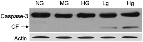 Figure 2. Downregulation of UCP2 expression in the groups of genipin induced caspase-3 cleavage. CF, cleaved fragments of caspase-3.