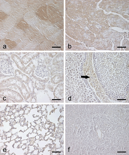 Figure 3.  Immunohistochemical staining of CA III in different mouse tissues. The EDL muscle (a) shows occasional strongly stained muscle fibers, while a weaker positive signal is observed in the heart (b). The kidney (c) shows only very faint staining in the renal tubules. In the testis (d), a very weak positive signal is detected in the interstitial cells (arrow). The lung (e) and spleen (f) are completely negative. Bars 50 µm.