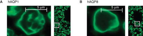 Figure 3. Membrane localization of hAQP1 and hAQP8 in P. pastoris. Yield profiles for GFP fusion proteins of hAQP1 (A) and hAQP8 (B) in P. pastoris. Cells shown are from a culture at 48 h post-induction.