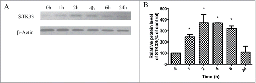 Figure 5. Effect of Ionomycin in Fadu cells on STK33 protein expression. (A) Representative protein gel blots showed the alterations in protein expressions of STK33 in the cells after exposure to 1.5 μM Ionomycin for 0 h, 1 h, 2 h, 4 h, 6 h and 24 h. (B) Graphs show the mean ± SEM after normalization to β-Actin protein. Results shown as means ± SEM, *p < 0 .05.