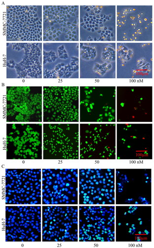 Figure 11. Effects of compound MY-1121 on morphology changes of liver cancer cells. Liver cancer cells were treated for 48 h. (A) Cell morphology in the bright field; (B) number of live cells (green) to dead cells (red); and (C) cell nuclei changes.