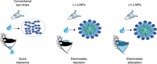 Figure 2 Schematic illustration of differently charged L/NP carriers containing dexamethasone.Abbreviation: L/NP, lipid nanoparticle.
