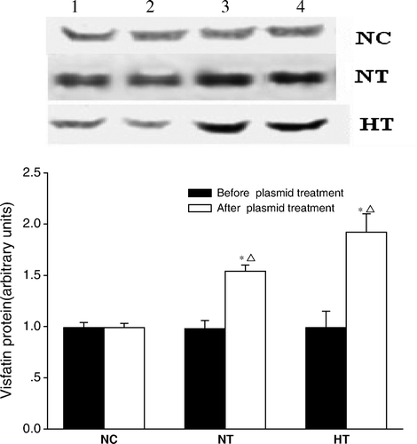 Figure 1.  Plasma visfatin/PBEF/Nampt protein levels in normal controls treated with pcDNA3.1(+) (NC; n=5), normal-chow rats treated with pcDNA3.1-visfatin (NT; n=5), and high-fat-fed rats treated with pcDNA3.1-visfatin (HT; n=5) for 4 days. Each experiment was performed in triplicate. Plasma samples were taken under following experimental conditions: Lane 1, basal values; Lane 2, at the end of first clamp; Lane 3, day 4 after plasmid injection; and Lane 4, at the end of second clamp.